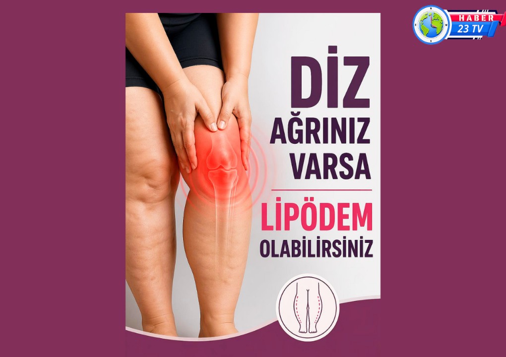 Nedeni Bilinmeyen Diz Ağrılarının Altından ‘Lipödem’ Çıkabilir..